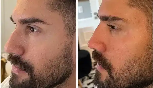 De cara nova, Bill Araújo passa por transformação radical