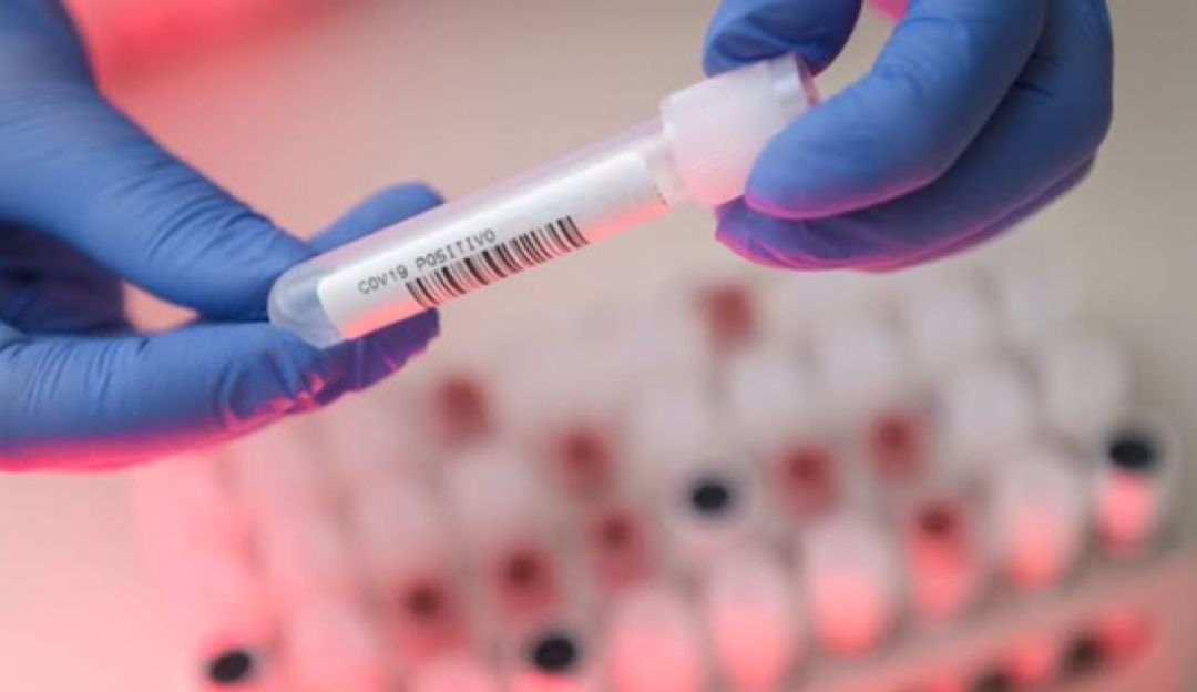 Coronavírus: reinfecção se torna uma possibilidade