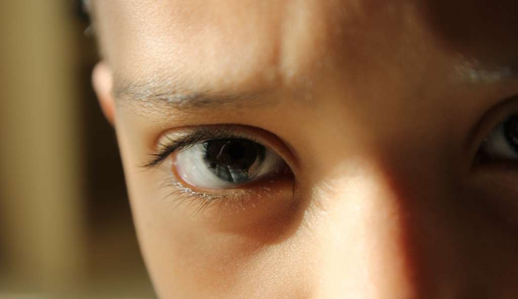 Retinoblastoma: o câncer que afeta crianças