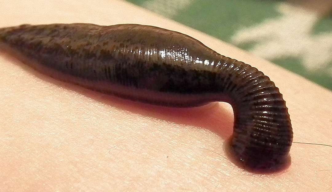 Sanguessugas voltam a ser utilizadas com frequência na medicina moderna