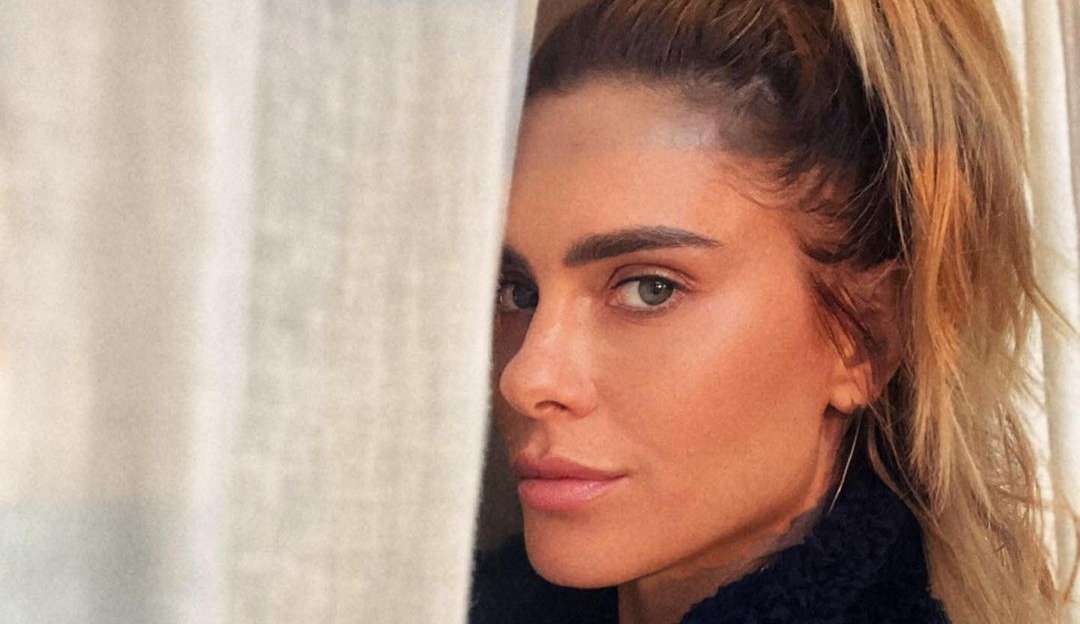 Carolina Dickman nega procedimentos estéticos