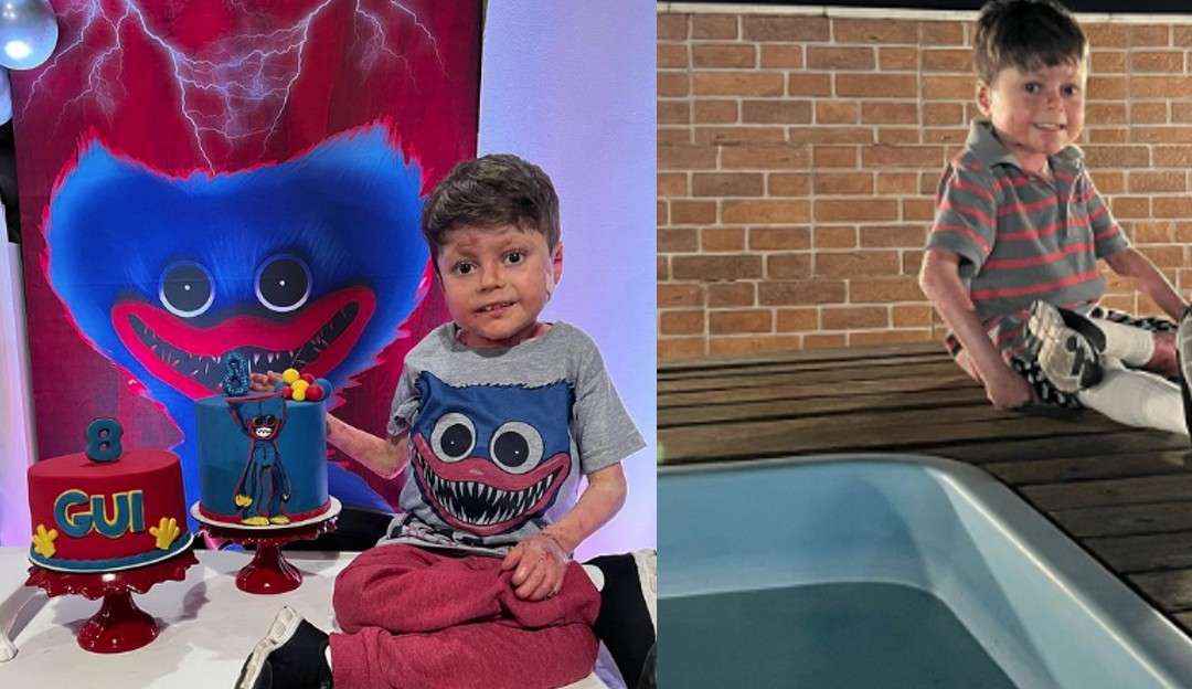 Menino de 8 anos com doença rara recebe alta em  hospital