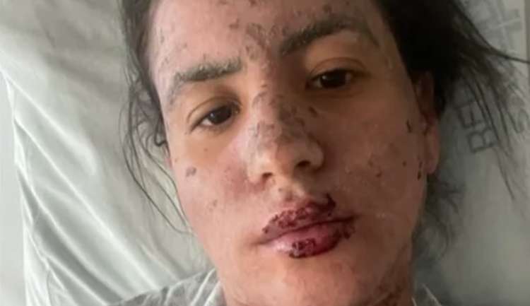 Esposa de Frank Aguiar fala do apoio do cantor durante momento difícil: “Deu o melhor dele”