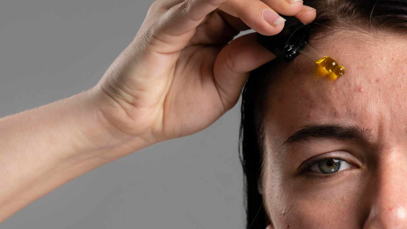 Saiba porque novos cosméticos tem o costume de causar acne