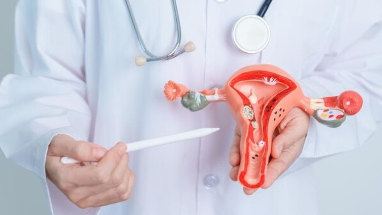 Endometriose: como diagnosticar a doença que afetou Patrícia Poeta e outras famosas
