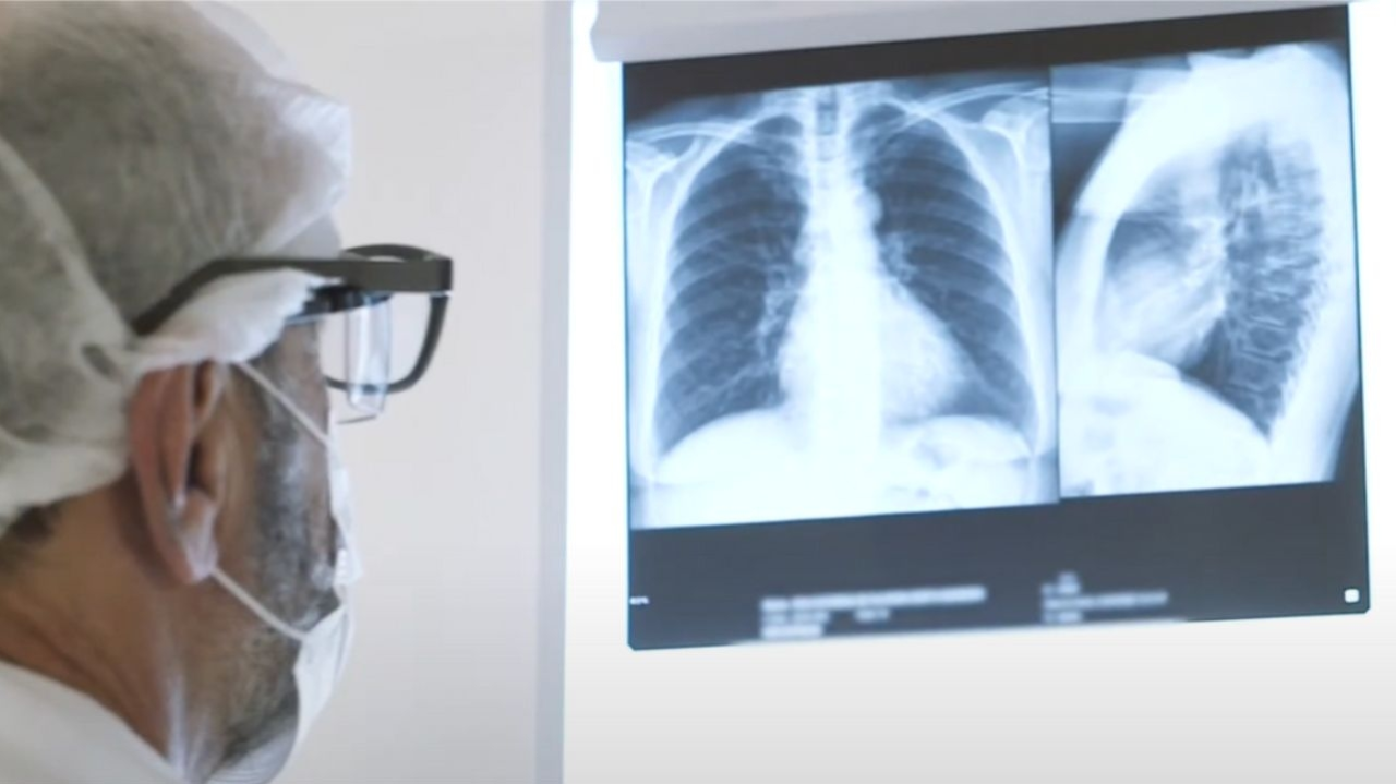 Profissionais de saúde explicam como virose pode evoluir para pneumonia