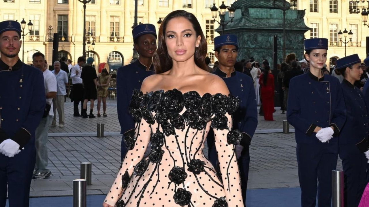 Anitta sofre queimadura de água viva durante passeio em Ibiza