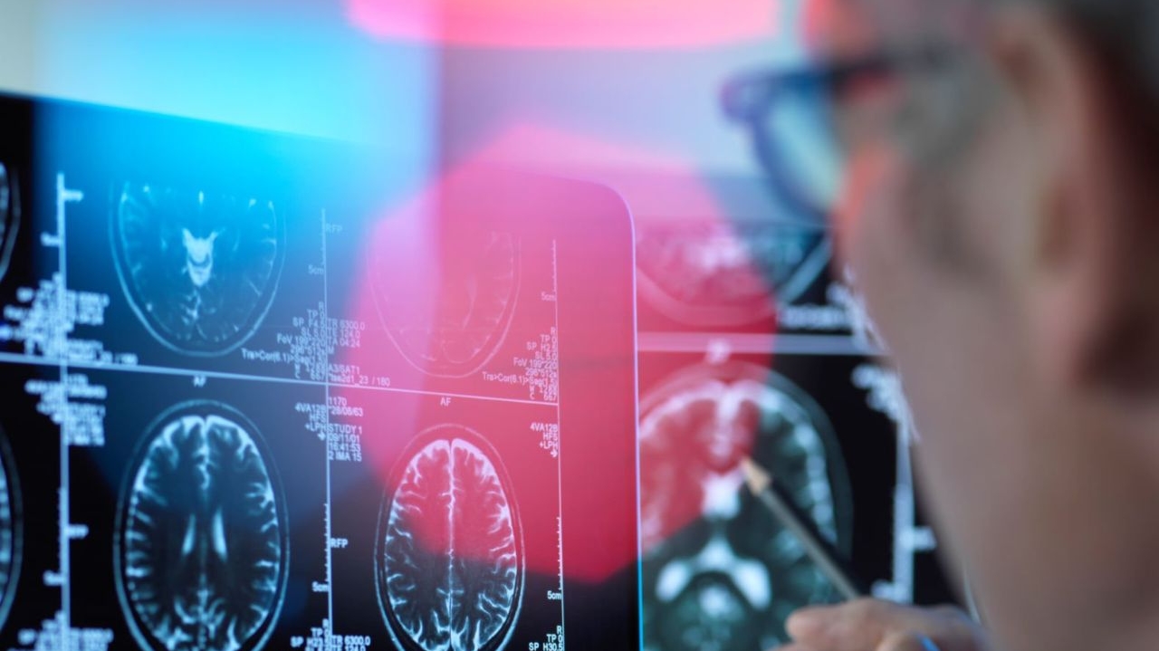 Estudo revela principais fatores causadores de demência no mundo