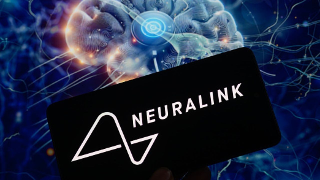 Elon Musk anuncia o sucesso do novo implante de chip cerebral em humanos
