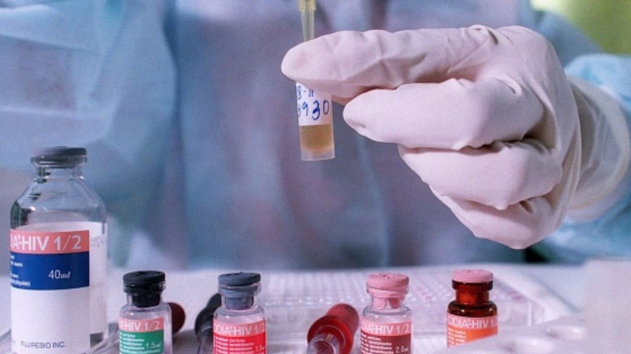 Pesquisa revela nova variante do HIV no Brasil