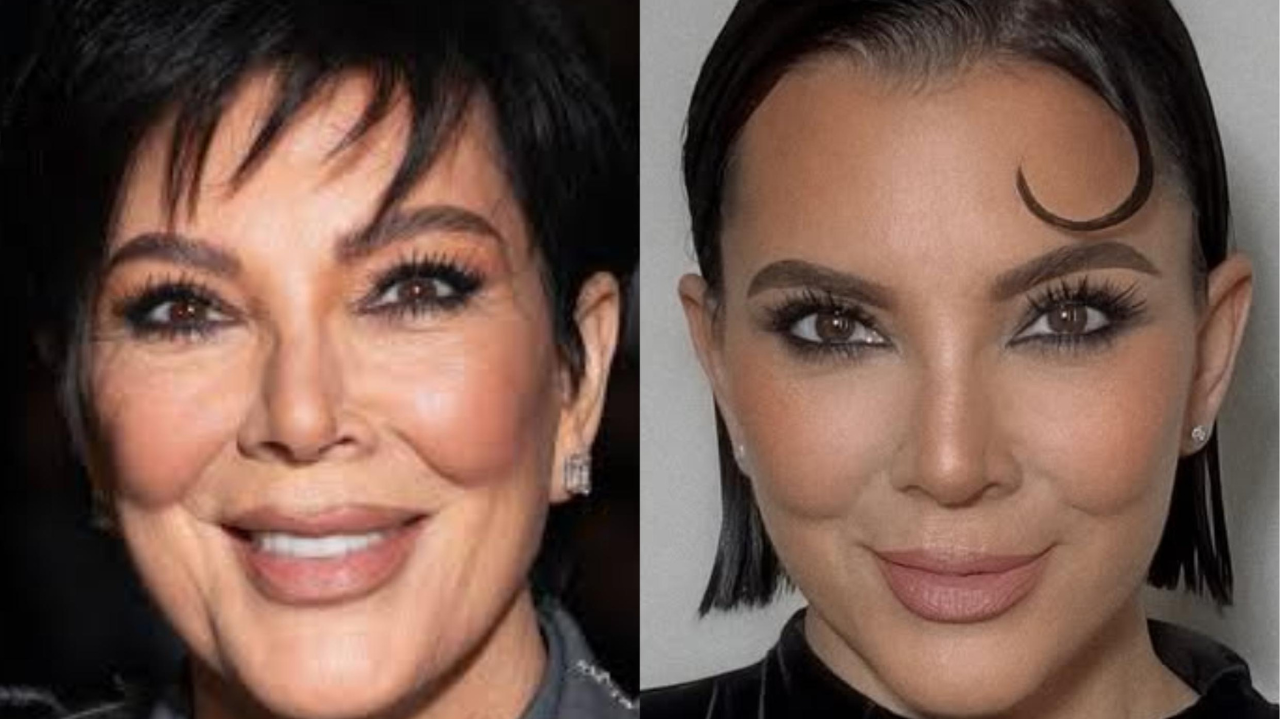 Kris Jenner desafia a idade aos 69: especialista explica como a estética regenerativa pode transformar um rosto maduro