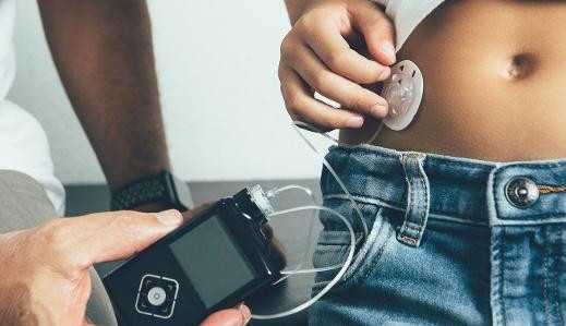 Como funcionam as bombas de insulina?